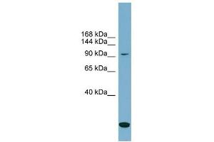 SLC12A4 antibody used at 1 ug/ml to detect target protein.