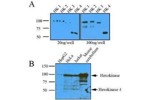 (A): Recombinant protein (20ng or 100ng) of Hexokinase four isoform were resolved by SDS-PAGE, transferred to nitrocellulose membrane and probed with anti-human Hexokinase (1:1000). (Hexokinase anticorps  (AA 1-917))