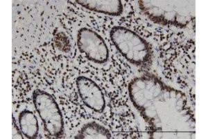 Image no. 1 for anti-CD3e Molecule, epsilon Associated Protein (CD3EAP) (AA 2-111) antibody (ABIN599522) (CD3EAP anticorps  (AA 2-111))