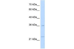 WB Suggested Anti-MAFB Antibody Titration:  1. (MAFB anticorps  (N-Term))