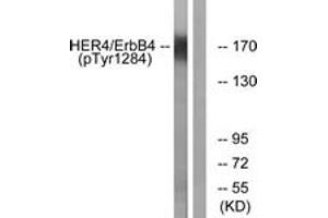 Western blot analysis of extracts from HuvEc cells treated with EGF 200ng/ml 30', using HER4 (Phospho-Tyr1284) Antibody. (ERBB4 anticorps  (pTyr1284))