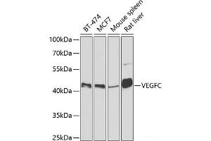 Western blot analysis of extracts of various cell lines using VEGFC Polyclonal Antibody at dilution of 1:500. (VEGFC anticorps)
