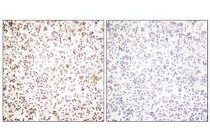Immunohistochemical analysis of paraffin-embedded human lymph node tissue using OCT-1 antibody (ABIN5976471). (POU2F1 anticorps  (N-Term))