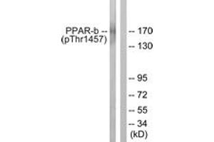 Western blot analysis of extracts from HuvEc cells treated with Serum 20% 30', using PPAR-BP (Phospho-Thr1457) Antibody. (PPAR-BP (AA 1423-1472), (pThr1457) anticorps)