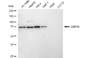 Western blotting analysis using GRP78 antibody (ABIN7798855).