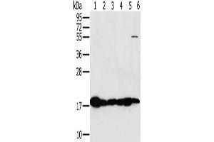 Gel: 10 % SDS-PAGE, Lysate: 40 μg, Lane 1-6: Mouse heart tissue, Mouse muscle tissue, hela cells, mouse liver tissue tissue, mouse kidney tissue, hepg2 cells, Primary antibody: ABIN7130290(MTFP1 Antibody) at dilution 1/450, Secondary antibody: Goat anti rabbit IgG at 1/8000 dilution, Exposure time: 5 seconds (Mtfp1 anticorps)