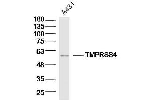 Lane 1: A431 lysates probed with TMPRSS4 Polyclonal Antibody, Unconjugated  at 1:300 overnight at 4˚C. (TMPRSS4 anticorps  (AA 84-130))