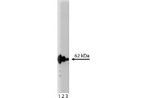 Western Blotting (WB) image for anti-p62 Lck Ligand (AA 257-437) antibody (ABIN968203) (p62 Lck Ligand (AA 257-437) anticorps)