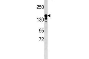 ABCC9 antibody western blot analysis in mouse kidney tissue lysate. (ABCC9 anticorps  (AA 640-669))