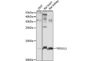 Western blot analysis of extracts of various cell lines, using TPD52L3 antibody (ABIN7271078) at 1:1000 dilution. (TPD52L3 anticorps  (AA 1-132))