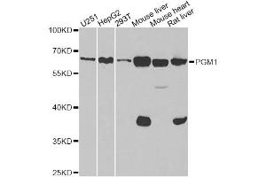 Western blot analysis of extracts of various cell lines, using PGM1 antibody. (Phosphoglucomutase 1 anticorps)