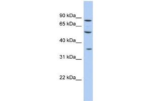 WB Suggested Anti-FAM63A Antibody Titration: 0. (FAM63A anticorps  (Middle Region))