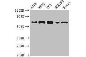 Western Blot Positive WB detected in: A375 whole cell lysate, K562 whole cell lysate, PC-3 whole cell lysate, HEK293 whole cell lysate, Mouse heart tissue All lanes: GBP2 antibody at 6. (GBP2 anticorps  (AA 100-259))