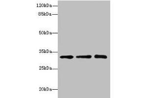 Western blot All lanes: RRAS2 antibody at 4. (SGCD anticorps  (AA 60-289))