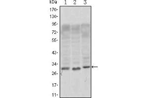 Western blot analysis using CD69 mouse mAb against, Jurkat (1), L1210 (2) and TPH-1 (3) cell lysate. (CD69 anticorps)