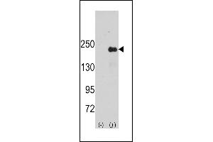 Western blot analysis of SG9 (arrow) using rabbit polyclonal SG9 Antibody (Center) (ABIN391447 and ABIN2841430). (SPAG9 anticorps  (AA 603-632))