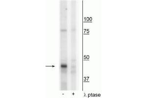 Western blot of mouse mitochondria from whole brain lysate showing specific immunolabeling of the ~46 kDa CK1Mt protein phosphorylated at Tyr153 in the first lane (-). (CKMT1A anticorps  (pTyr153))
