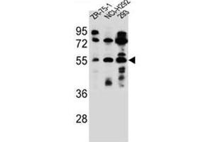 Western blot analysis of FUT6 Antibody (N-term) in ZR-75-1, NCI-H292, 293 cell line lysates (35ug/lane). (FUT6 anticorps  (N-Term))