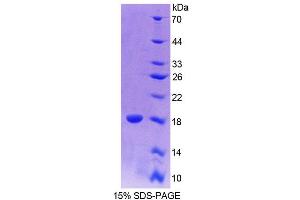 SDS-PAGE analysis of Mouse CALY Protein. (CALY Protéine)