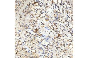 IHC analysis of SPTBN2 using anti-SPTBN2 antibody (ABIN7602111). (Spectrin, Beta, Non-erythrocytic 2 (SPTBN2) (AA 594-1909) anticorps)