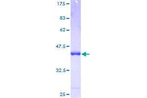 Image no. 1 for Lymphocyte Antigen 6 Complex, Locus D (LY6D) (AA 21-128) protein (GST tag) (ABIN1309900)