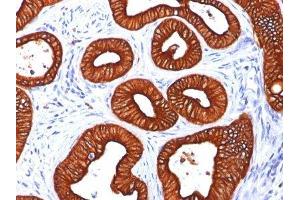 Image no. 5 for anti-Keratin 18 (KRT18) antibody (ABIN6179389) (Cytokeratin 18 anticorps)