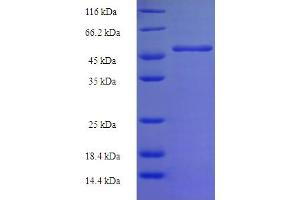 SDS-PAGE (SDS) image for Geranylgeranyl Diphosphate Synthase 1 (GGPS1) (AA 1-300), (full length) protein (His-SUMO Tag) (ABIN5709575)
