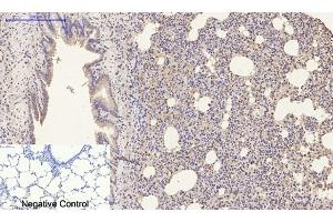 Immunohistochemical analysis of paraffin-embedded rat lung tissue. (Luciferase anticorps)