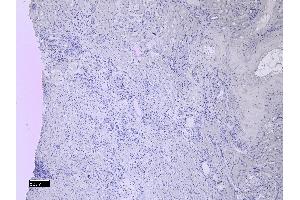 (ABIN571258) Negative Control showing staining of paraffin embedded Human Kidney, with no primary antibody.