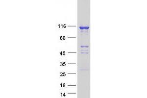 Validation with Western Blot