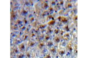 Used in DAB staining on fromalin fixed paraffin-embedded Liver tissue (TCF20 anticorps  (AA 125-213))
