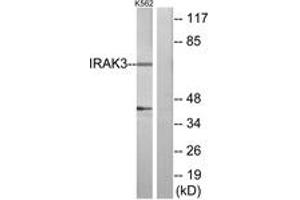 Western Blotting (WB) image for anti-Interleukin-1 Receptor-Associated Kinase 3 (IRAK3) (AA 491-540) antibody (ABIN2889831) (IRAK3 anticorps  (AA 491-540))