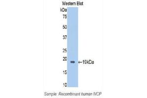 Western Blotting (WB) image for anti-CD46 (CD46) (AA 147-285) antibody (ABIN1174444) (CD46 anticorps  (AA 147-285))