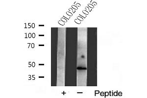 Western blot analysis of Actin γ2 expression in COLO205 cells (ACTG2 anticorps  (N-Term))