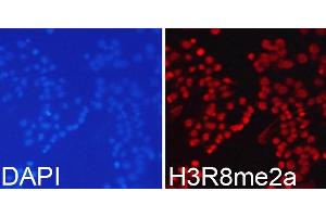 Immunofluorescence analysis of 293T cells using Asymmetric DiMethyl-Histone H3-R8 antibody (ABIN3017485, ABIN3017486, ABIN3017487 and ABIN6220109).
