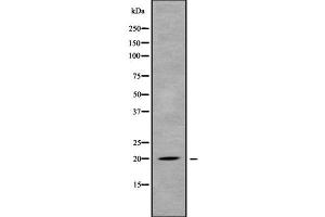 Western blot analysis of MED30 using MCF7 whole cell lysates (MED30 anticorps  (Internal Region))