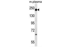 A2M Antibody (alpha 2 Macroglobulin anticorps  (N-Term))