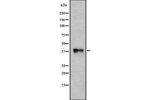 Western blot analysis of P2RY10 using HUVEC whole cell lysates (P2RY10 anticorps  (Internal Region))