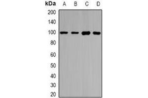 Western blot analysis of HIWI1 expression in HepG2 (A), SKOV3 (B), mouse testis (C), rat testis (D) whole cell lysates. (PIWIL1 anticorps)