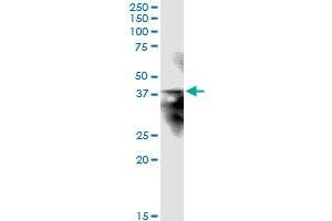 Immunoprecipitation of STX12 transfected lysate using anti-STX12 MaxPab rabbit polyclonal antibody and Protein A Magnetic Bead , and immunoblotted with STX12 MaxPab mouse polyclonal antibody (B01) .