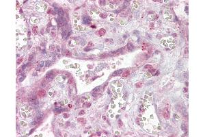 Anti-NFATC4 antibody IHC of human placenta. (NFATC4 anticorps  (AA 953-965))