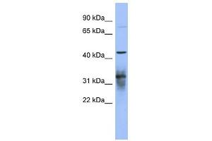 PABPC5 antibody used at 1 ug/ml to detect target protein. (PABPC5 anticorps)