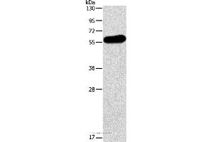 Western blot analysis of Human testis tissue, using APOH Polyclonal Antibody at dilution of 1:275 (APOH anticorps)