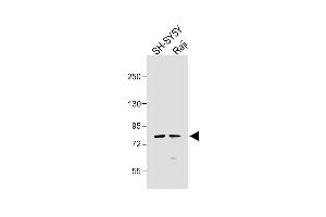 All lanes : Anti-K5 Antibody at 1:1000 dilution Lane 1: SH-SY5Y whole cell lysate Lane 2: Raji whole cell lysate Lysates/proteins at 20 μg per lane. (PAK7 anticorps  (AA 168-198))