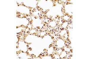 Immunohistochemistry analysis of paraffin-embedded rat lung using,CLIC6 (ABIN7073478) at dilution of 1: 600