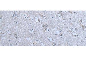 Immunohistochemistry of paraffin-embedded Human brain tissue using ZNF703 Polyclonal Antibody at dilution of 1:55(x200) (ZNF703 anticorps)