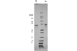 SDS-PAGE of Human Visfatin Recombinant Protein SDS-PAGE of Human Visfatin Recombinant Protein. (NAMPT Protéine)