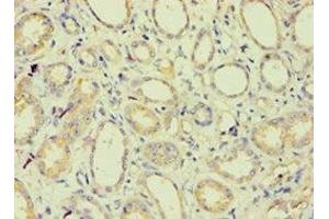 Immunohistochemistry of paraffin-embedded human kidney tissue using ABIN7145213 at dilution of 1:100