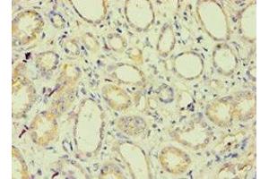 Immunohistochemistry of paraffin-embedded human kidney tissue using ABIN7145213 at dilution of 1:100 (BAG2 anticorps  (AA 1-211))