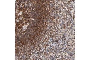 Immunohistochemical staining of human spleen with WIPF1 polyclonal antibody  shows strong cytoplasmic positivity in cells in red pulp and cells in white pulp. (WIPF1 anticorps)